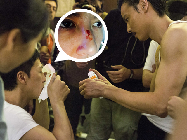 《葉問3》八斬刀互片 甄子丹被劈傷鼻樑