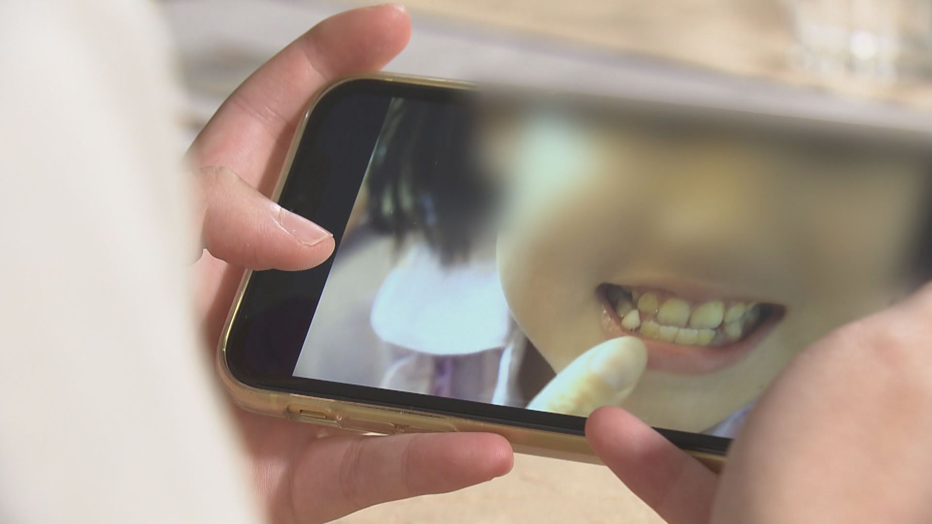 【杏林在線—健康1分鐘＋】如何處理孩子換牙？