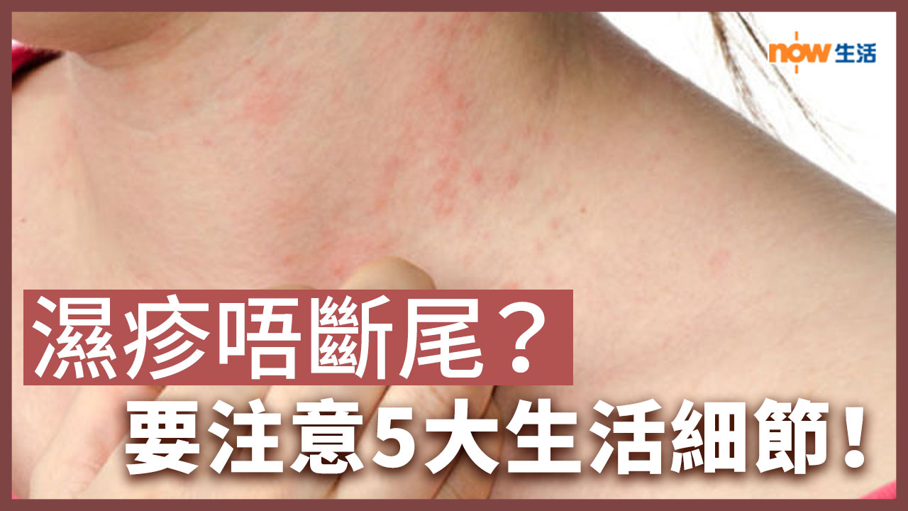 〈好Heal〉濕疹一直好不了？要注意5大生活細節！