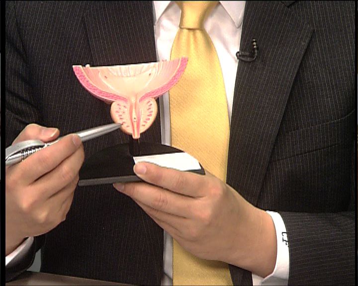 杏林在線：前列腺癌年青個案