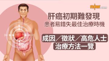 肝癌初期難察覺易錯失最佳治療時機　成因／徵狀／高危人士／治療方法一覽