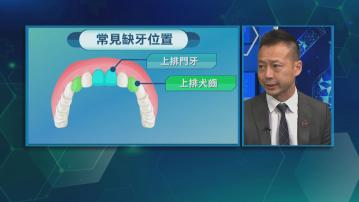 杏林在線｜少牙症 