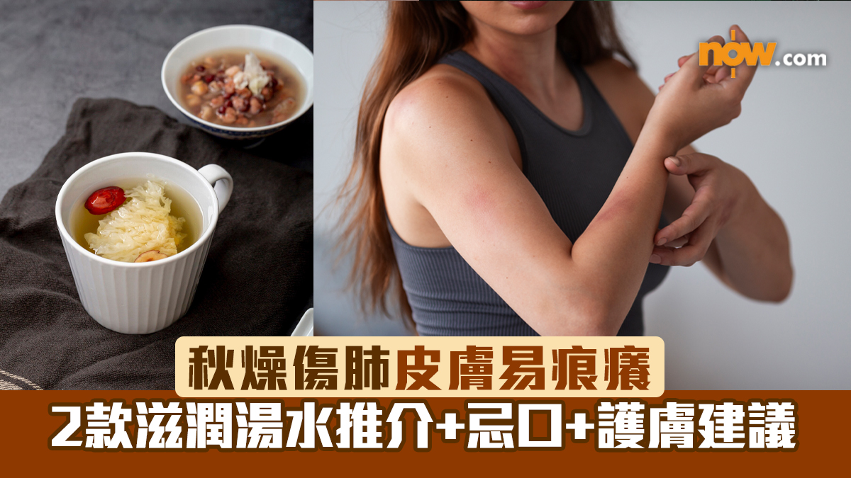 秋燥傷肺皮膚易痕癢　2款滋潤湯水推介+忌口+護膚建議