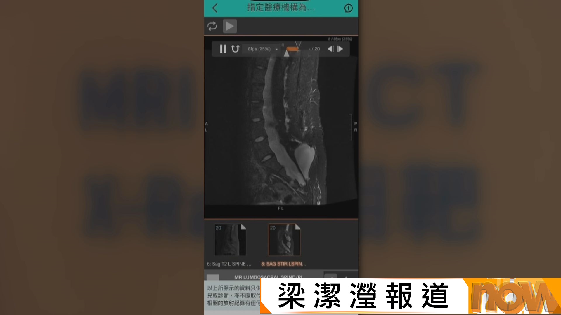 醫健通即日起可存入指定內地醫療機構放射檢查報告