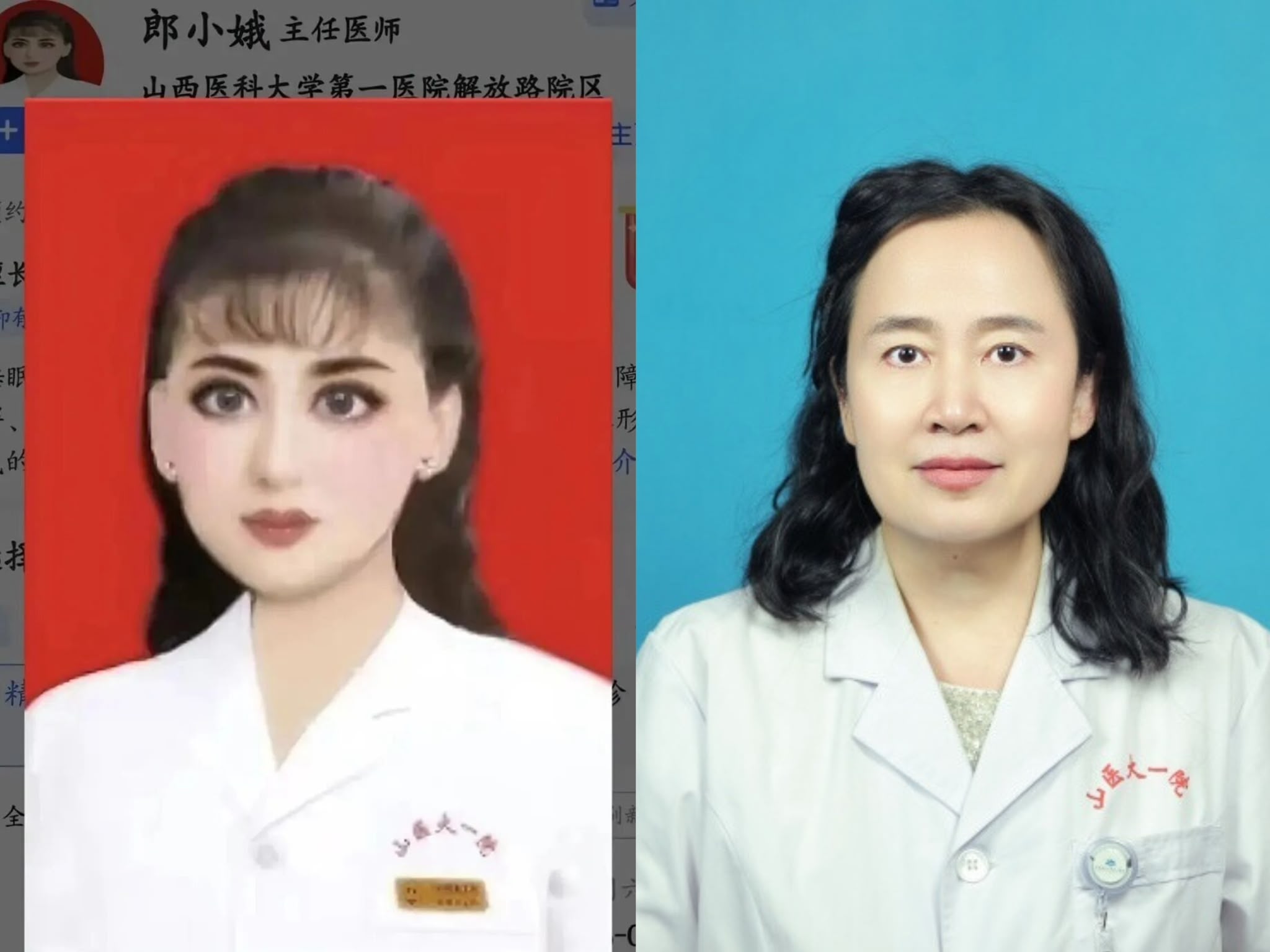 10級美顏｜山西精神科醫生誇張大眼磨皮照引發熱議　爆紅後改用素顏照人氣不減