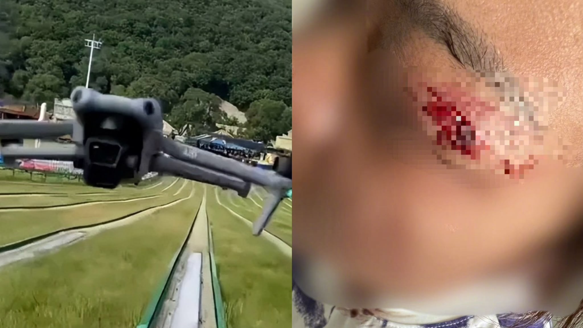 有片｜遊客在瀋陽景區遭失控無人機撞傷　面部淌血險失明 