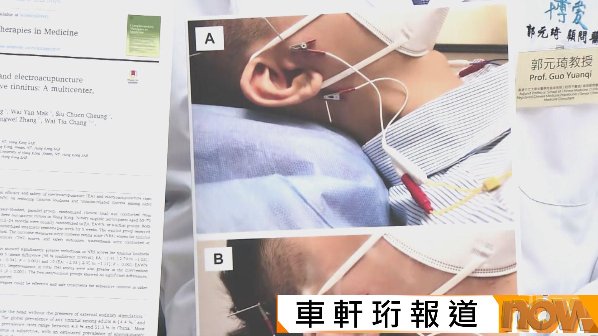 中大中醫學院研究發現針灸能改善中老年人耳鳴　可作為補充治療