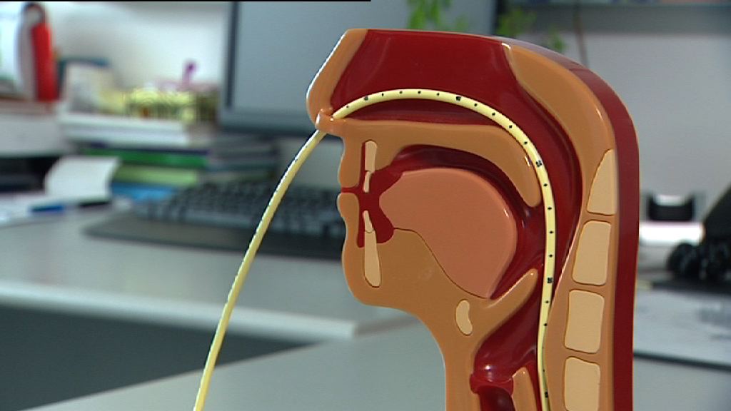 【杏林在線】鼻胃喉的需要性