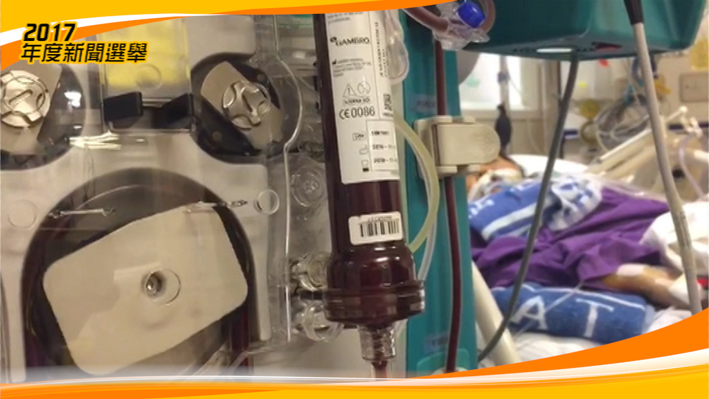 6.鄧桂思肝衰竭死亡 器官捐贈再諮詢