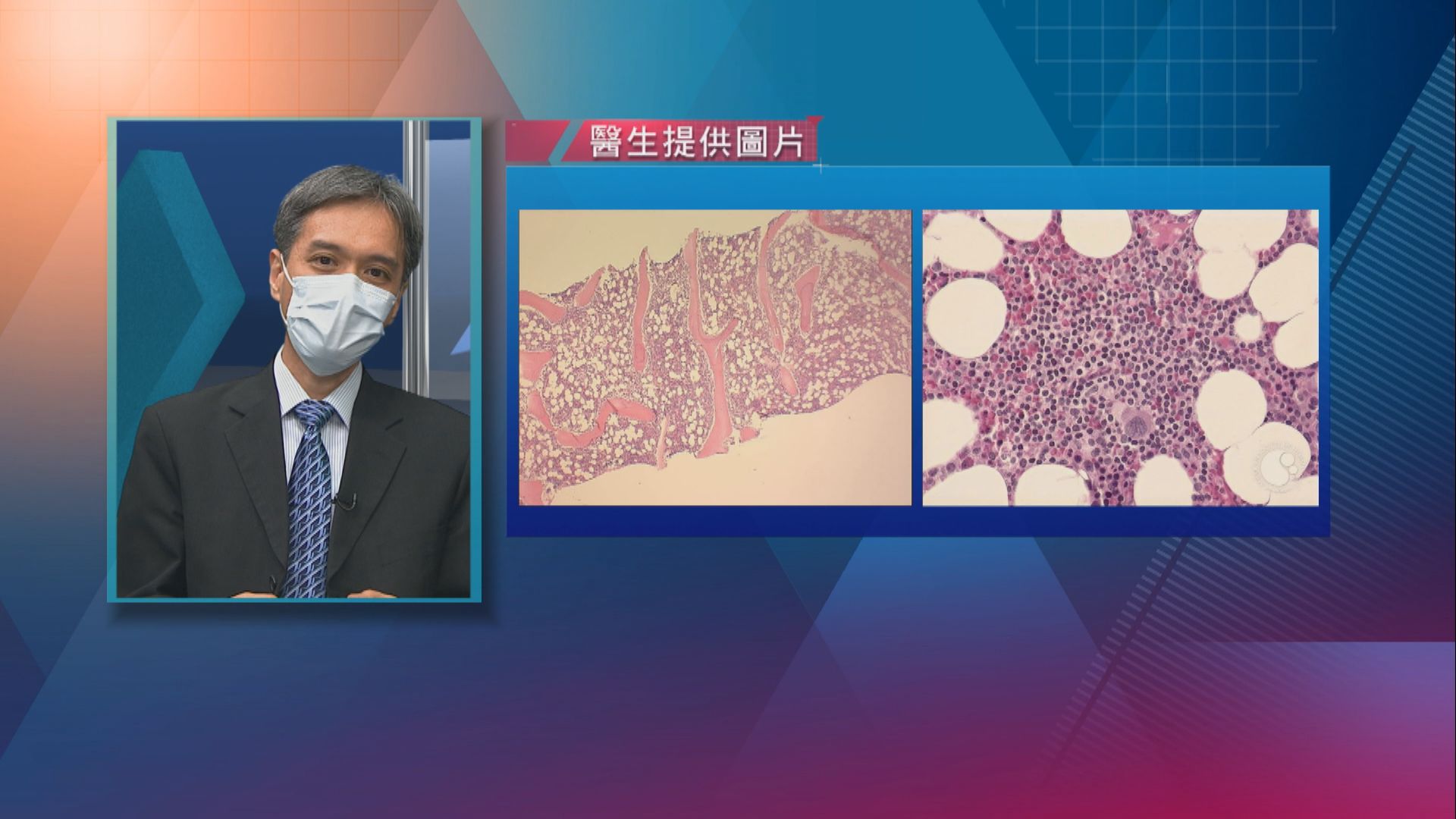 【杏林在線】認識再生障礙性貧血