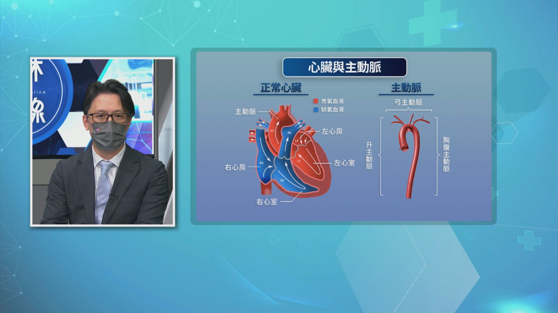 【杏林在線】胸腔主動脈瘤