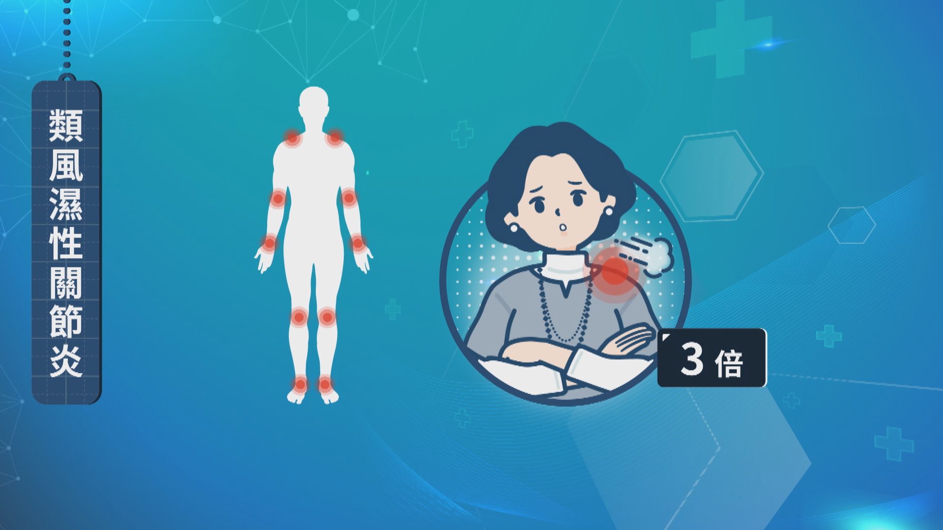 【杏林在線】類風濕關節炎