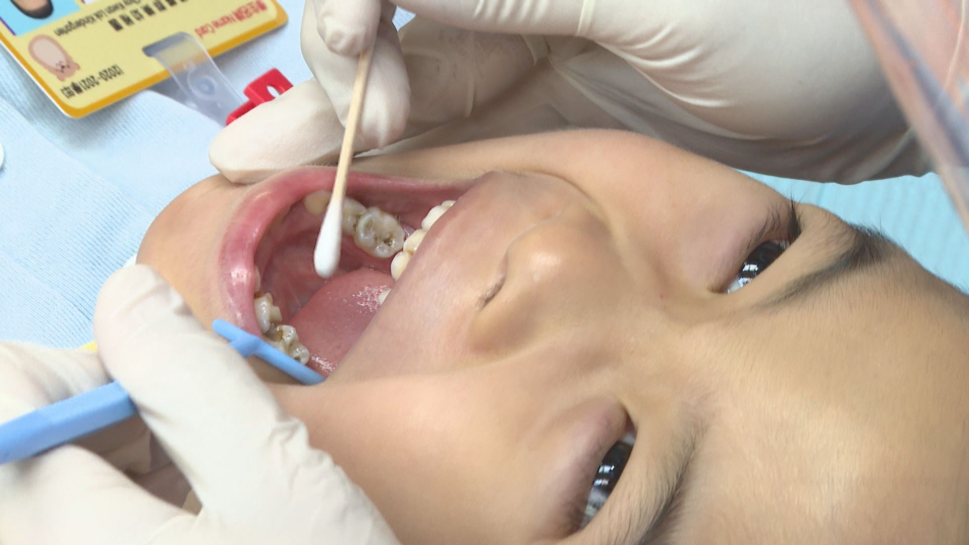 【杏林在線】幼童護齒法則