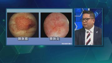 杏林在線｜血尿與膀胱癌