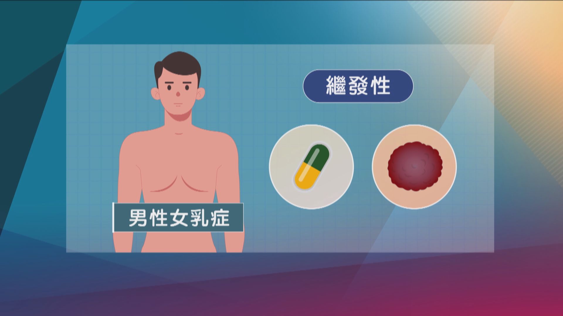 【杏林在線】直擊男性女乳症手術