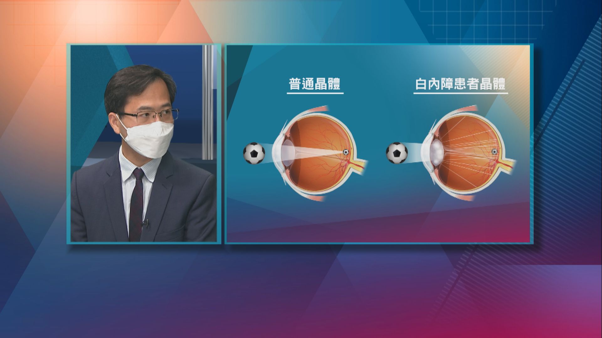 【杏林在線】小兒白內障