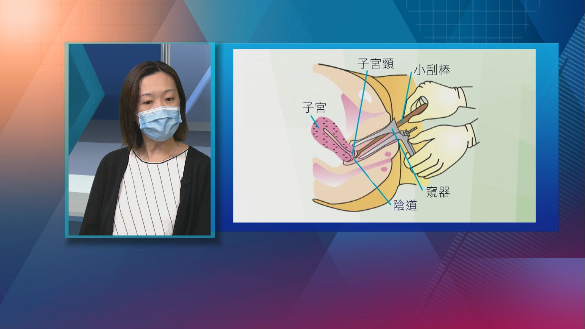 【杏林在線】預防子宮頸癌