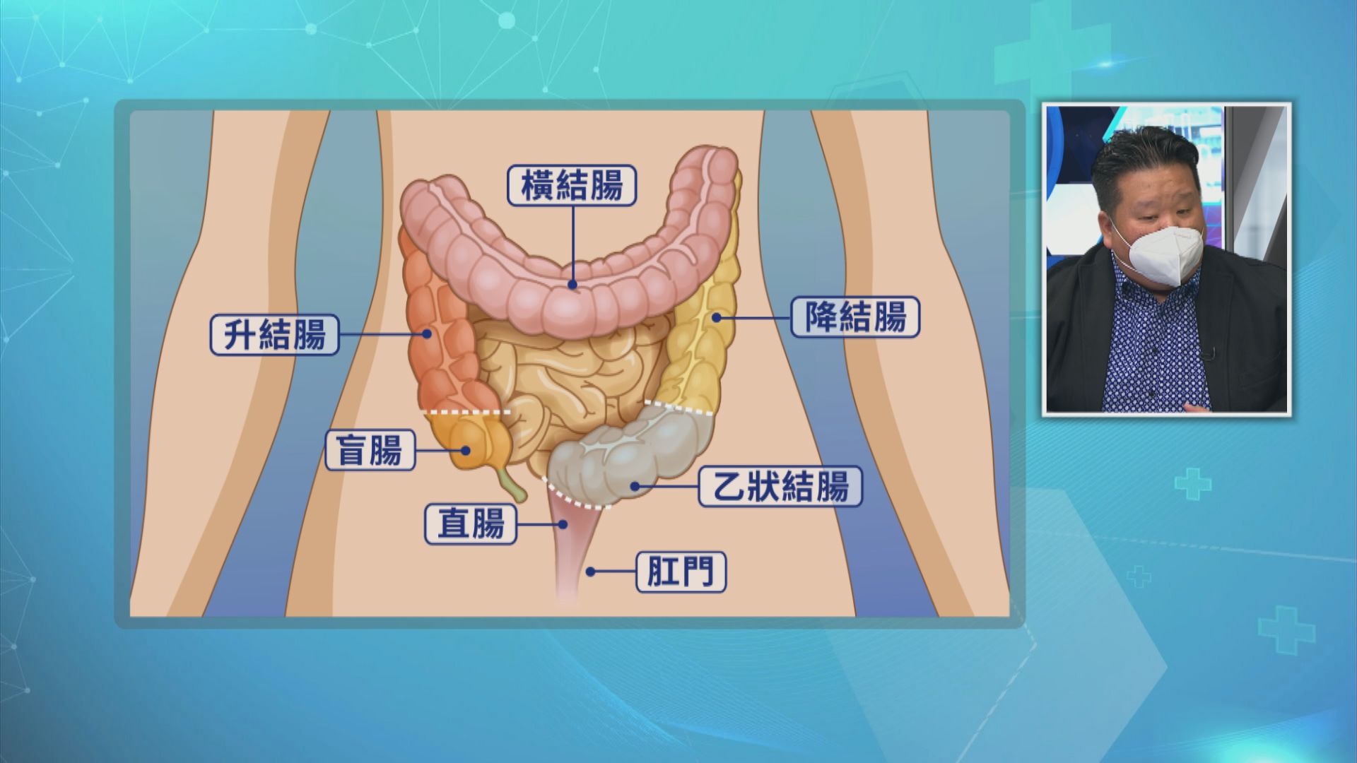 【杏林在線】中醫看大腸癌