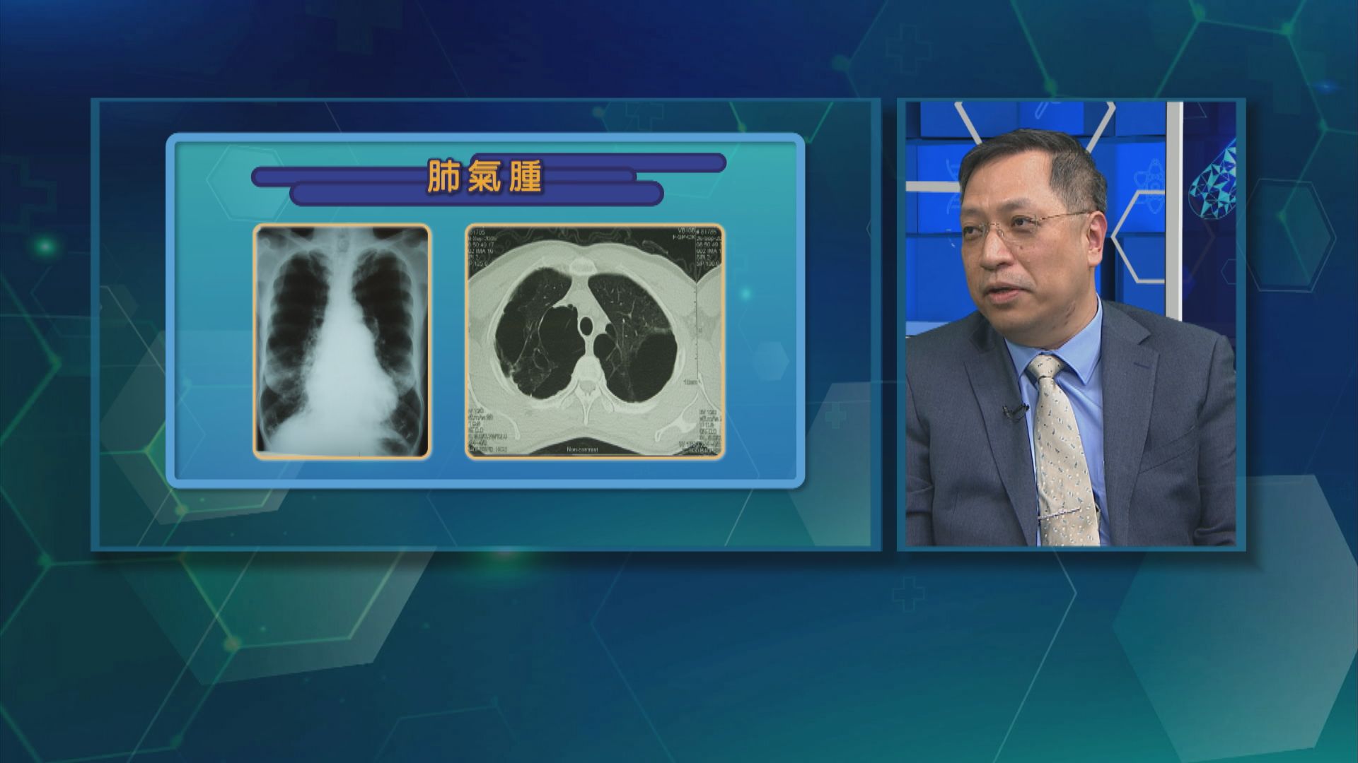 【杏林在線】慢性阻塞性肺病