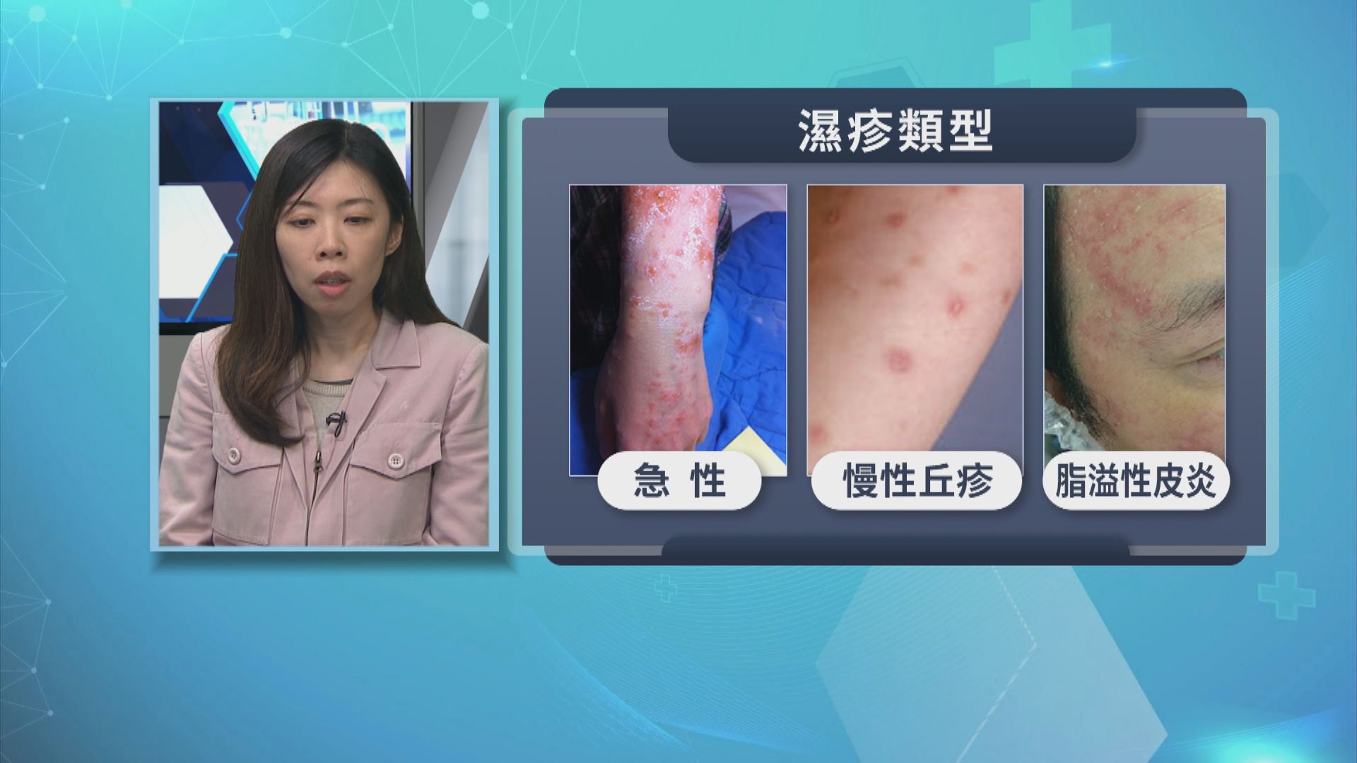 【杏林在線】濕疹及霉菌