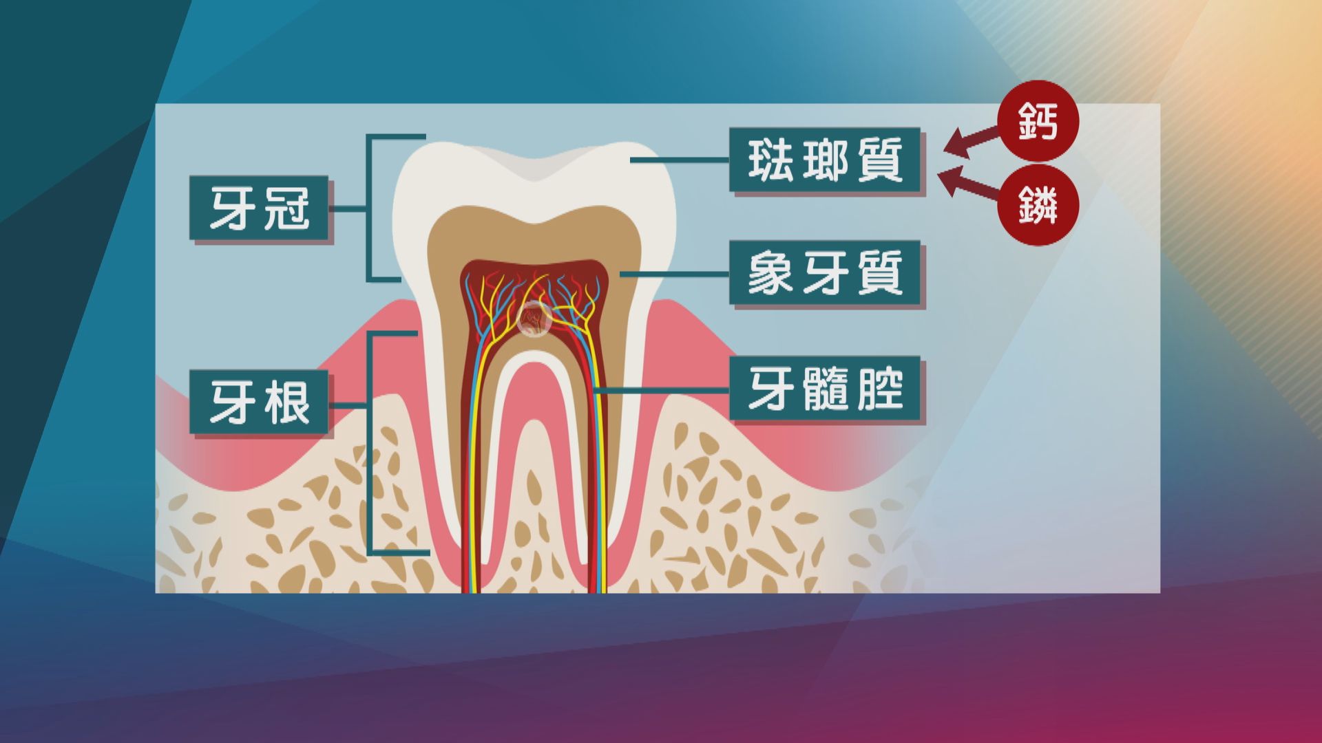 【杏林在線】消失的琺瑯質