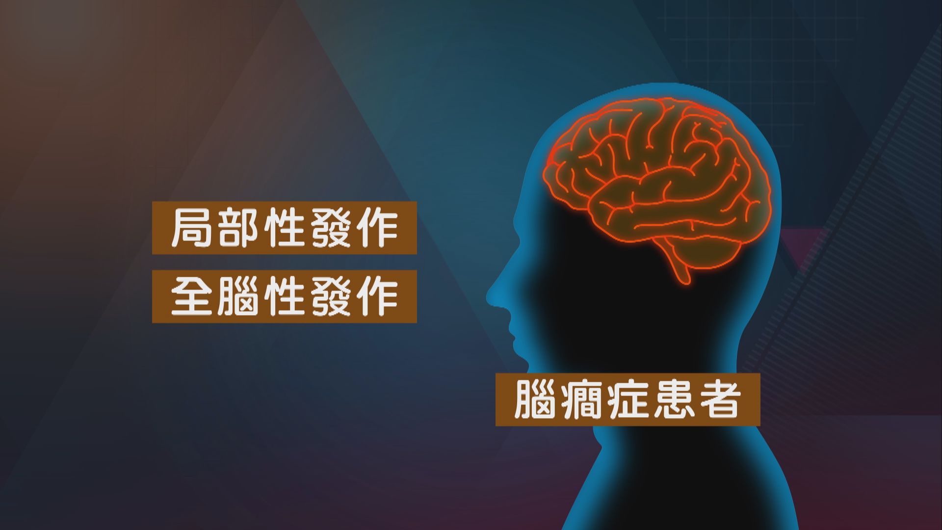 【杏林在線】異常的腦電波