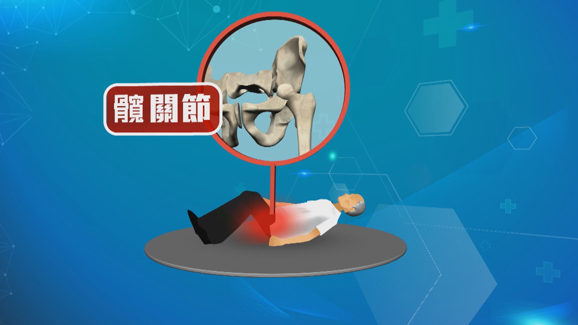 【杏林在線】如何不跌倒