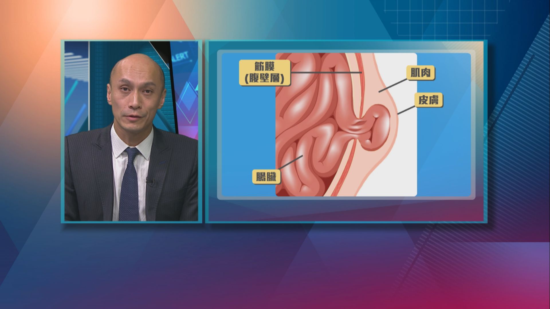 【杏林在線】小腸氣