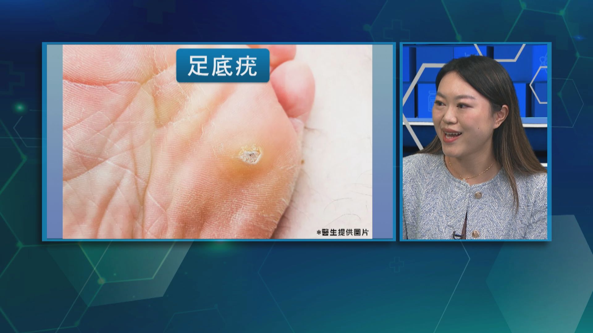 杏林在線｜HPV的迷思