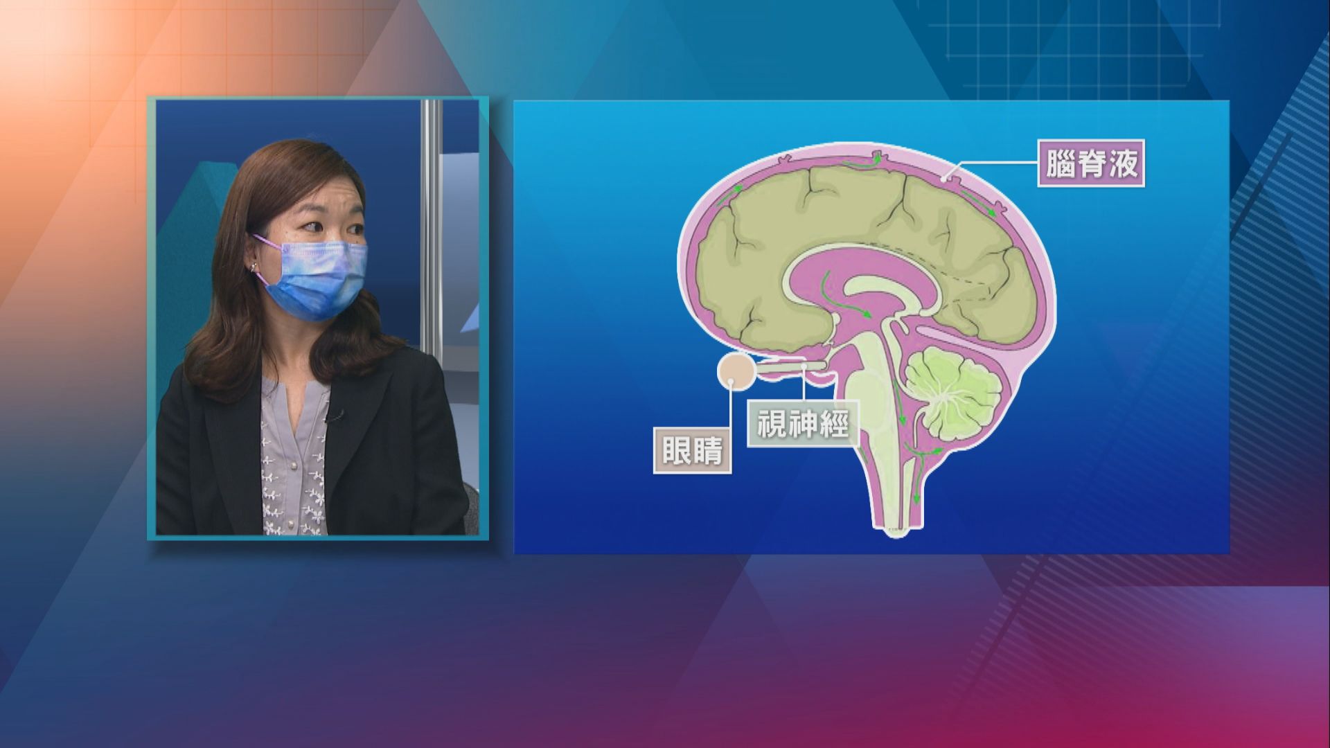 【杏林在線】認識原發性顱內高壓症