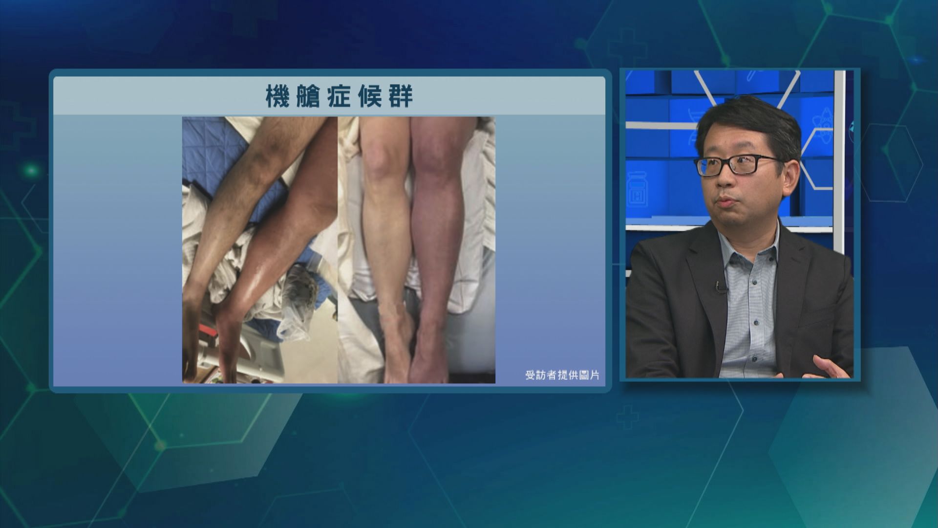 杏林在線｜機艙症候群