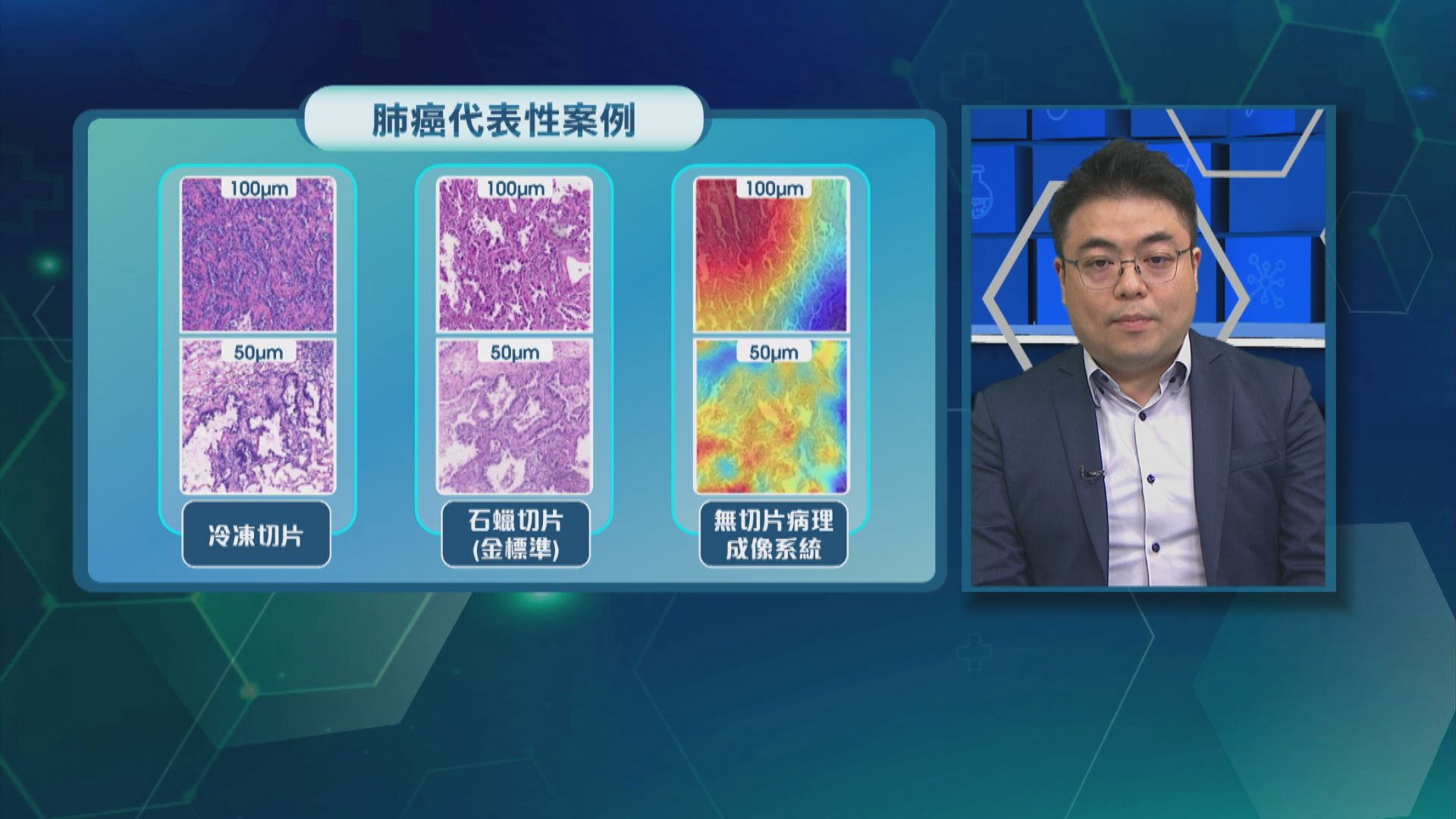 杏林在線｜三分鐘無切片驗癌