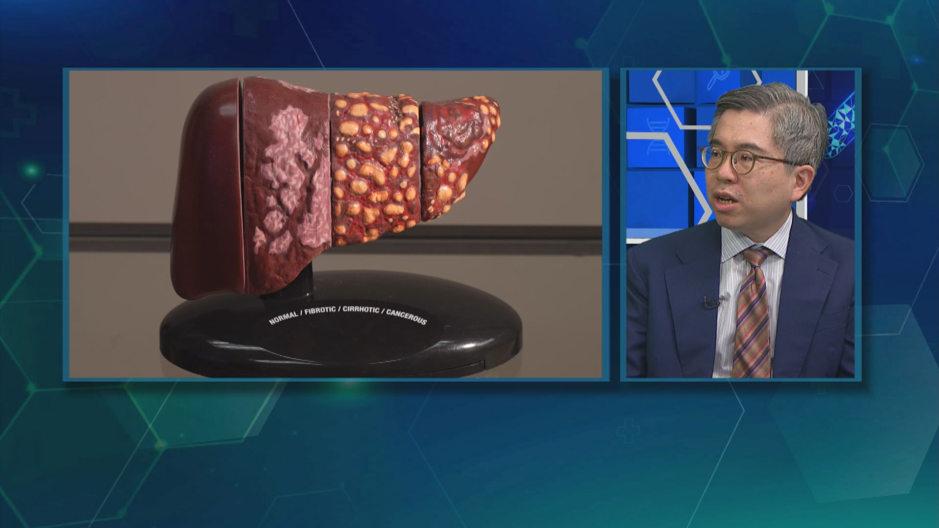 杏林在線｜預防肝癌 