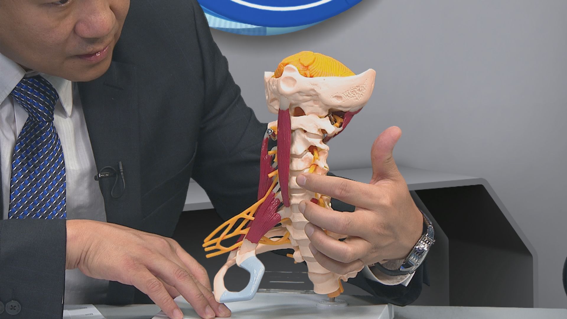 【杏林在線】中西醫看「瞓捩頸」