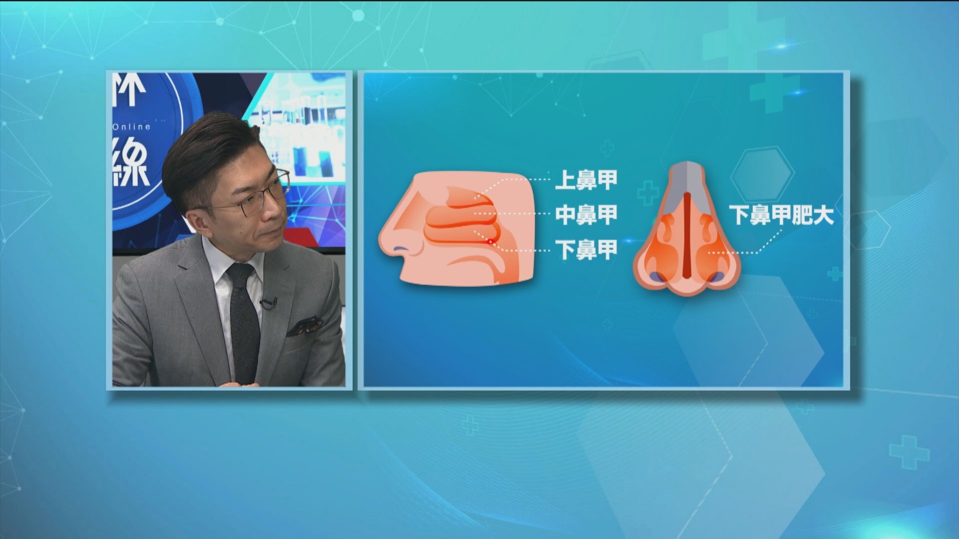 【杏林在線】功能性鼻整形手術