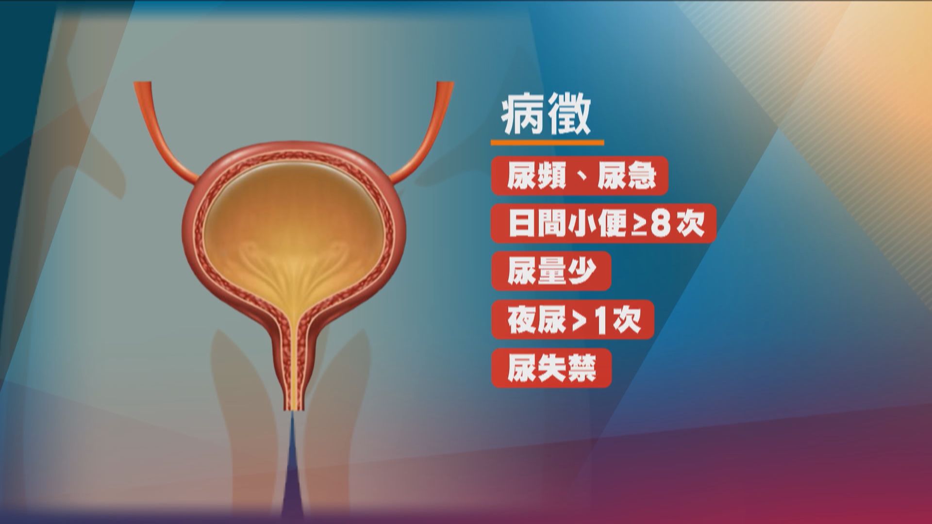 【杏林在線】好動的膀胱