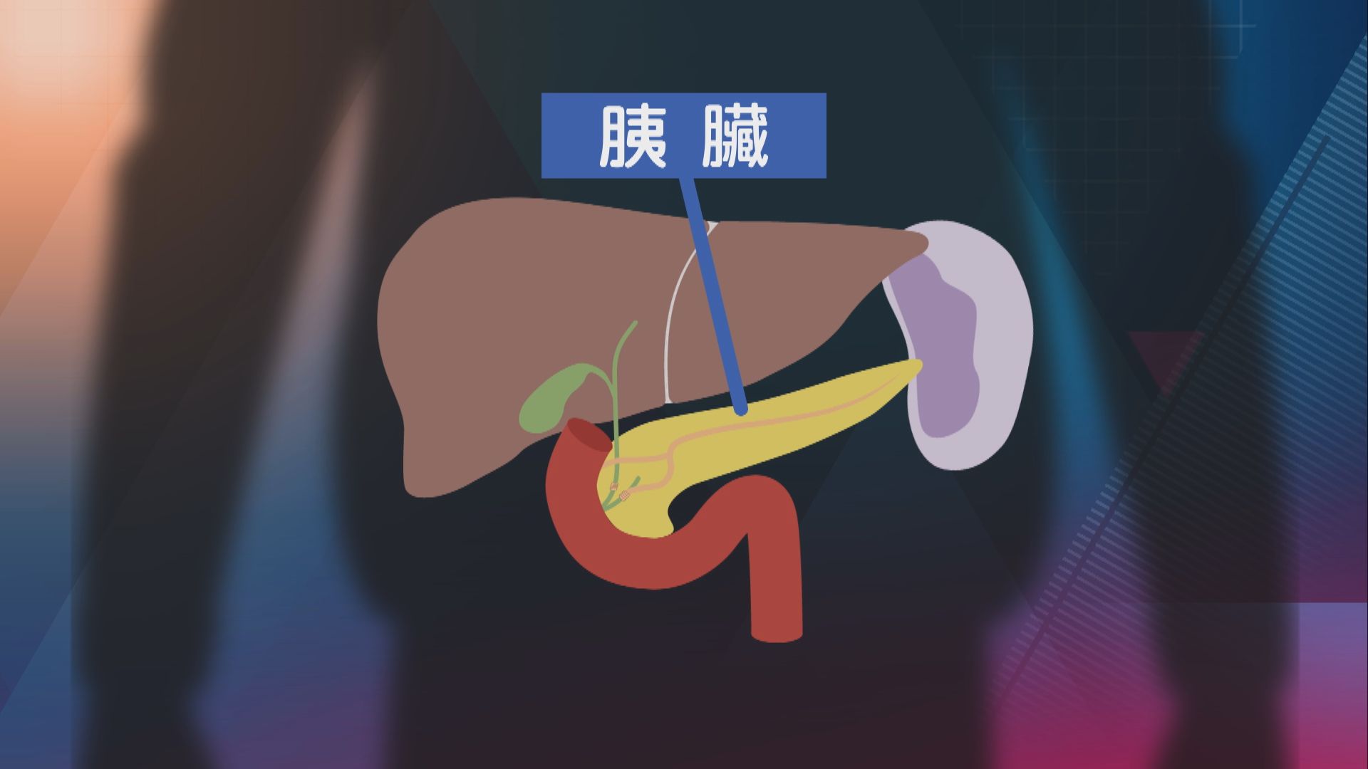 【杏林在線】悄悄來襲的胰臟癌