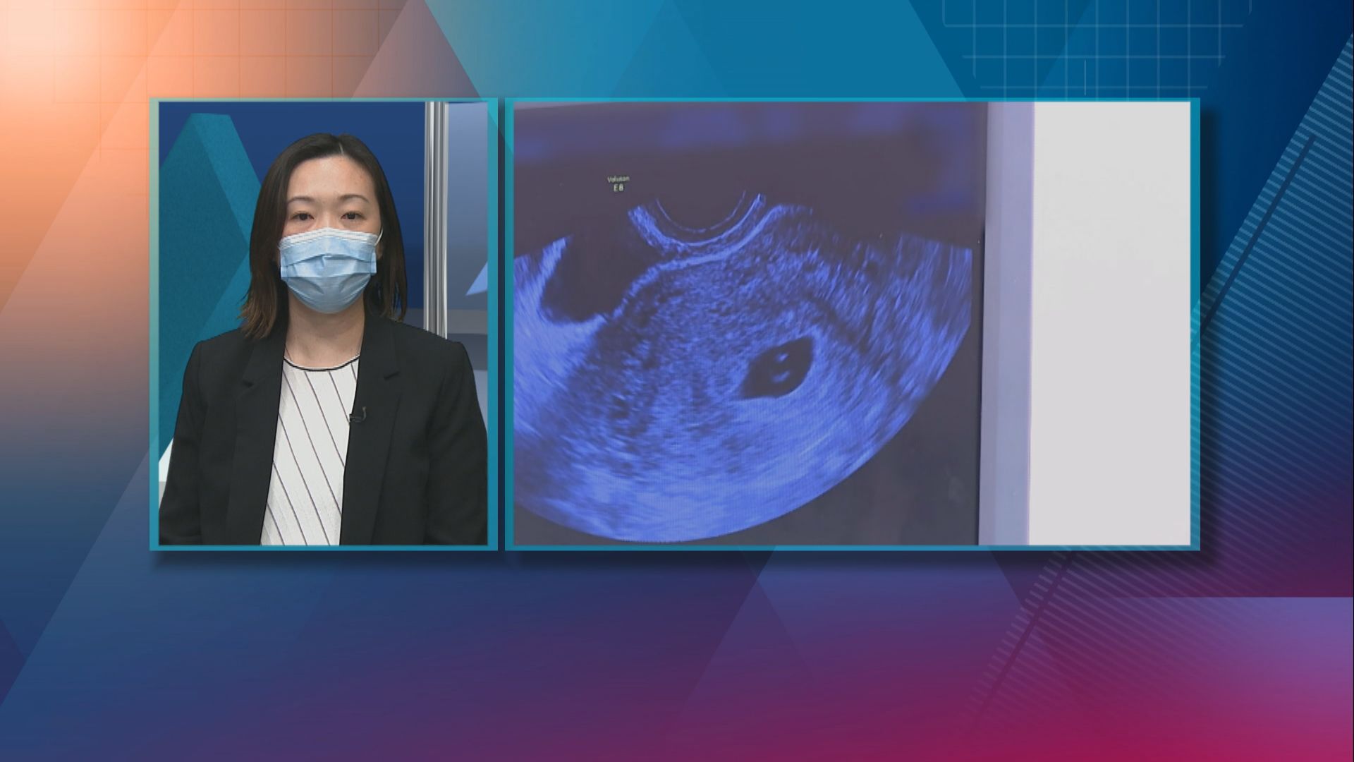 【杏林在線】婦女檢查知多點