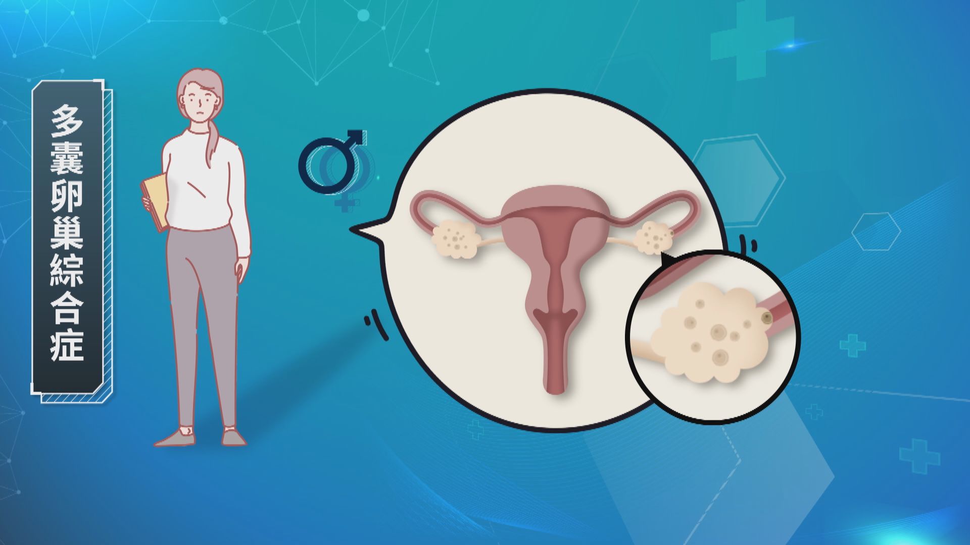 【杏林在線】難以生育的「泡泡」