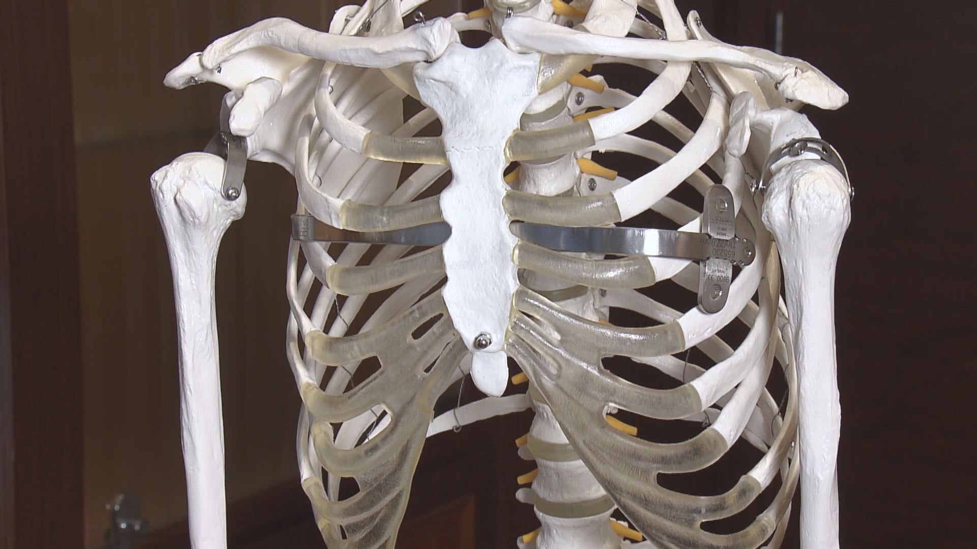 【杏林在線】凹陷的胸口