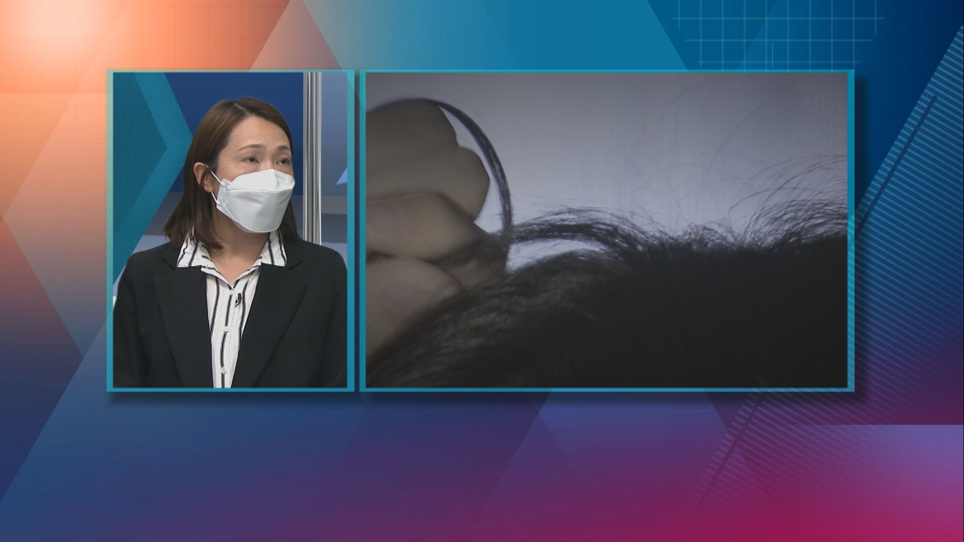 【杏林在線】重複拔除毛髮