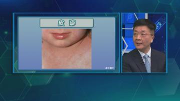 杏林在線｜預防猩紅熱