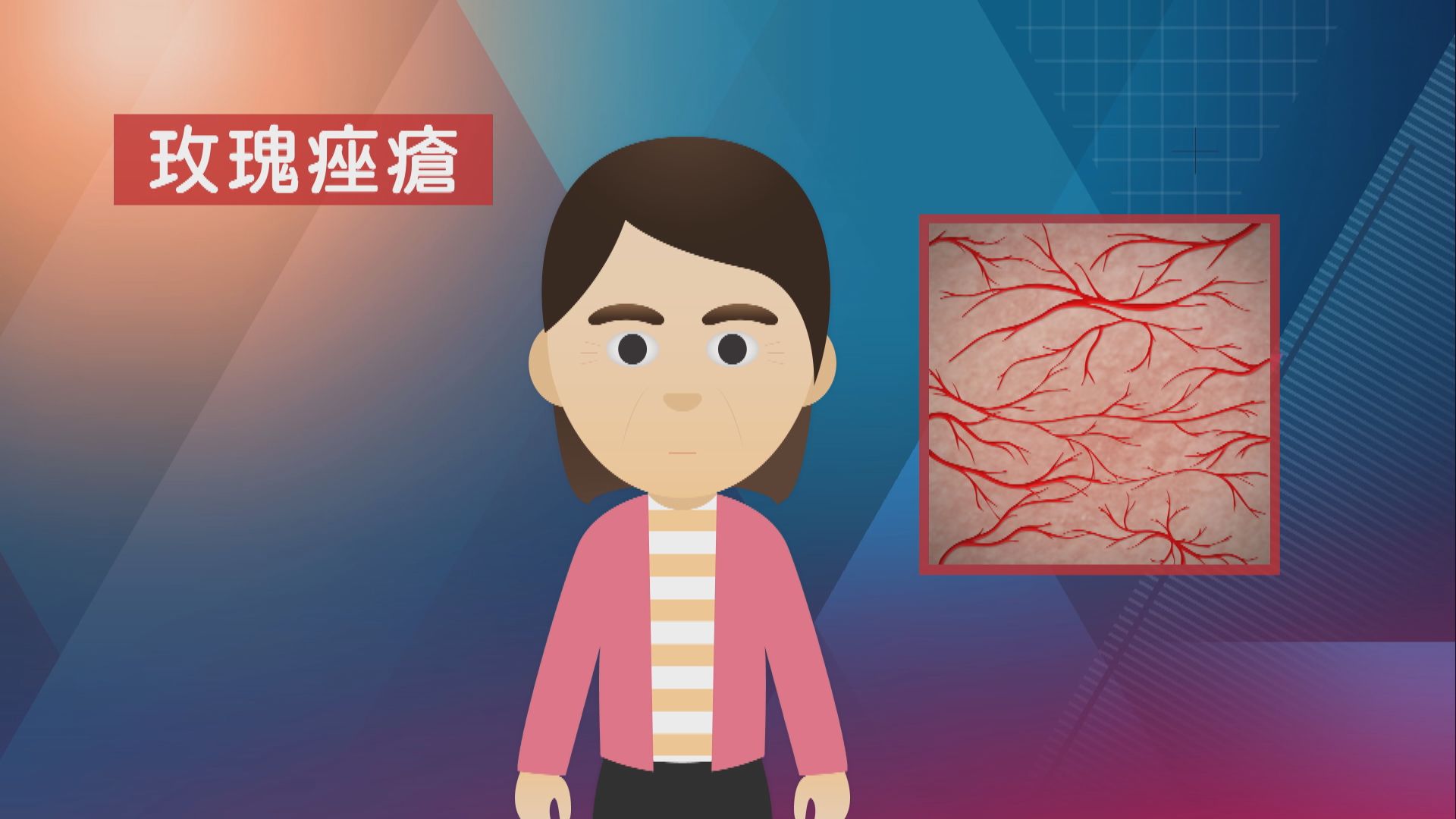 【杏林在線】玫瑰色的困擾