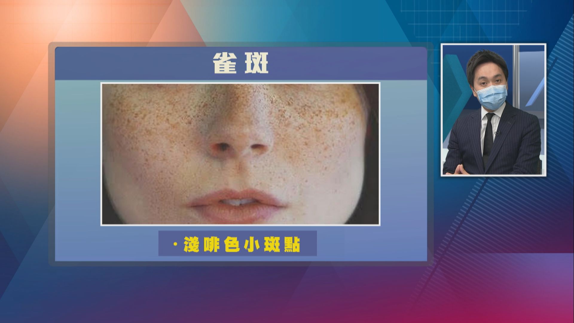 【杏林在線】色斑的困擾