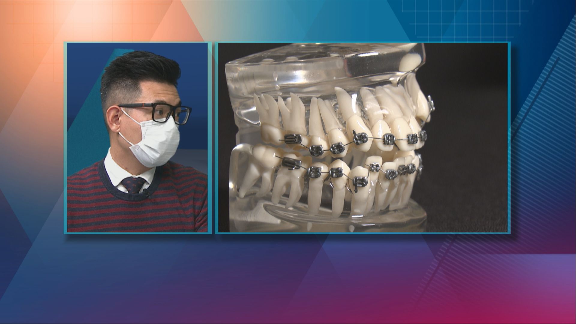 【杏林在線】傳統箍牙vs隱形牙套