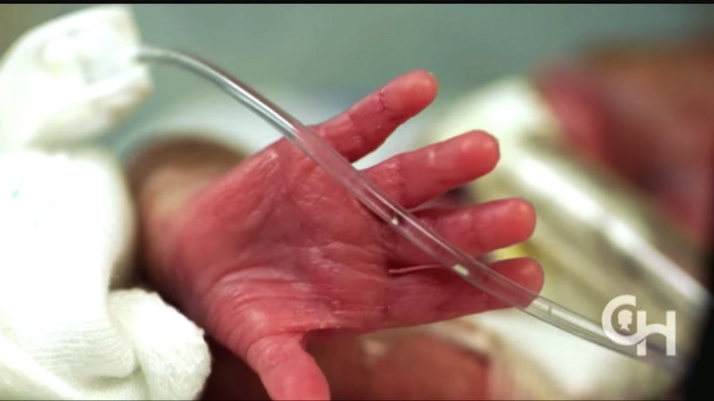 美學者研發人造子宮助早產嬰成長