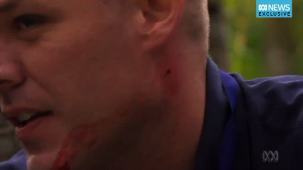 澳洲記者在菲律賓採訪中彈險喪命