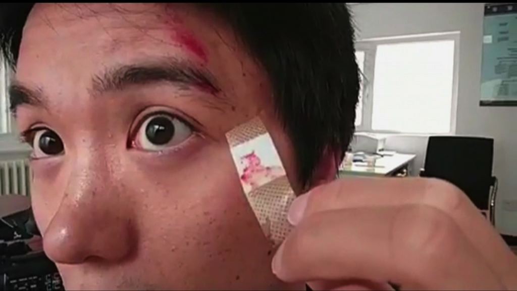 本台駐京攝影師額頭受傷　遭扣留逾兩小時後獲釋