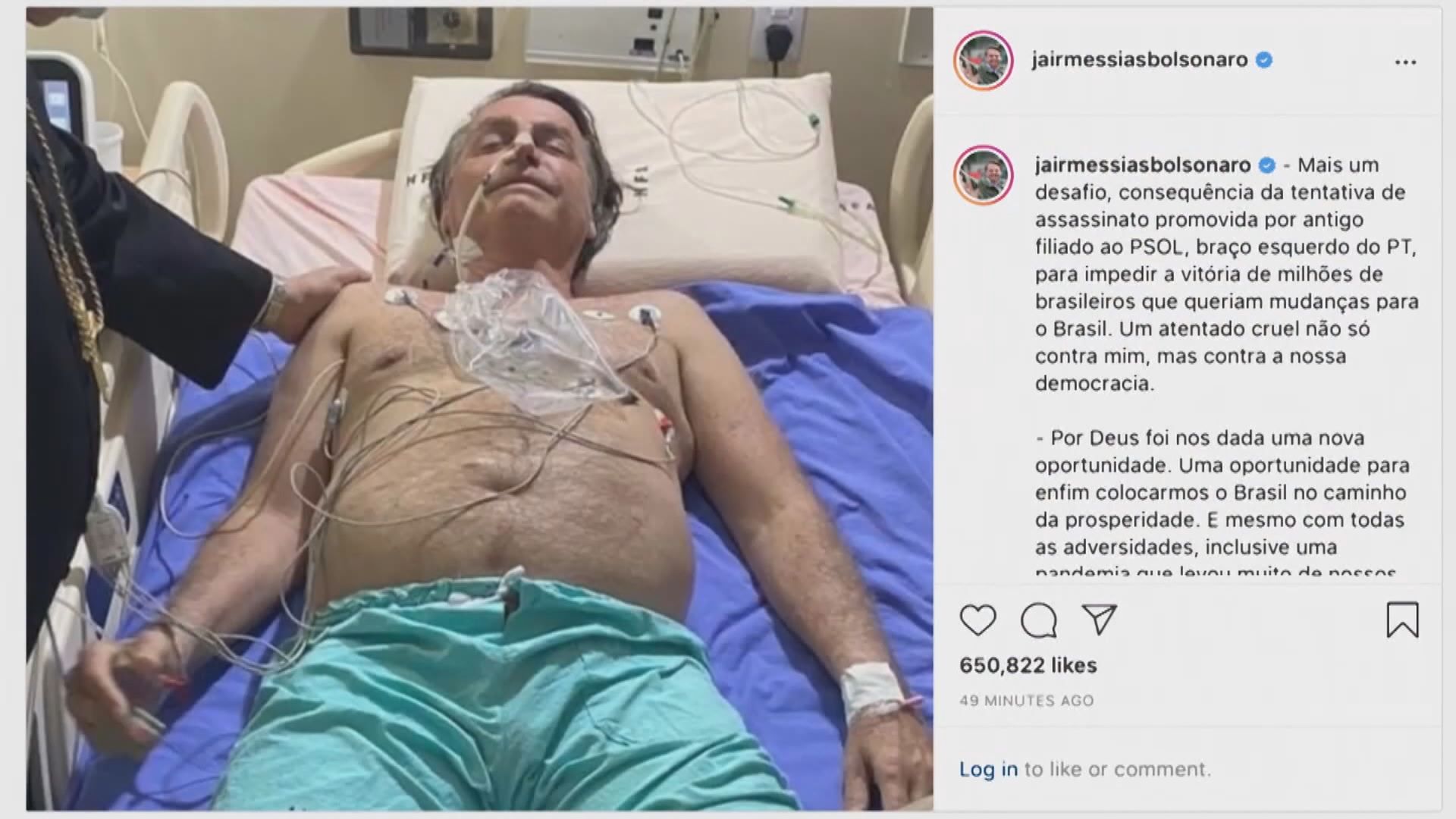 巴西總統因腹痛及持續打嗝逾十天送院治療