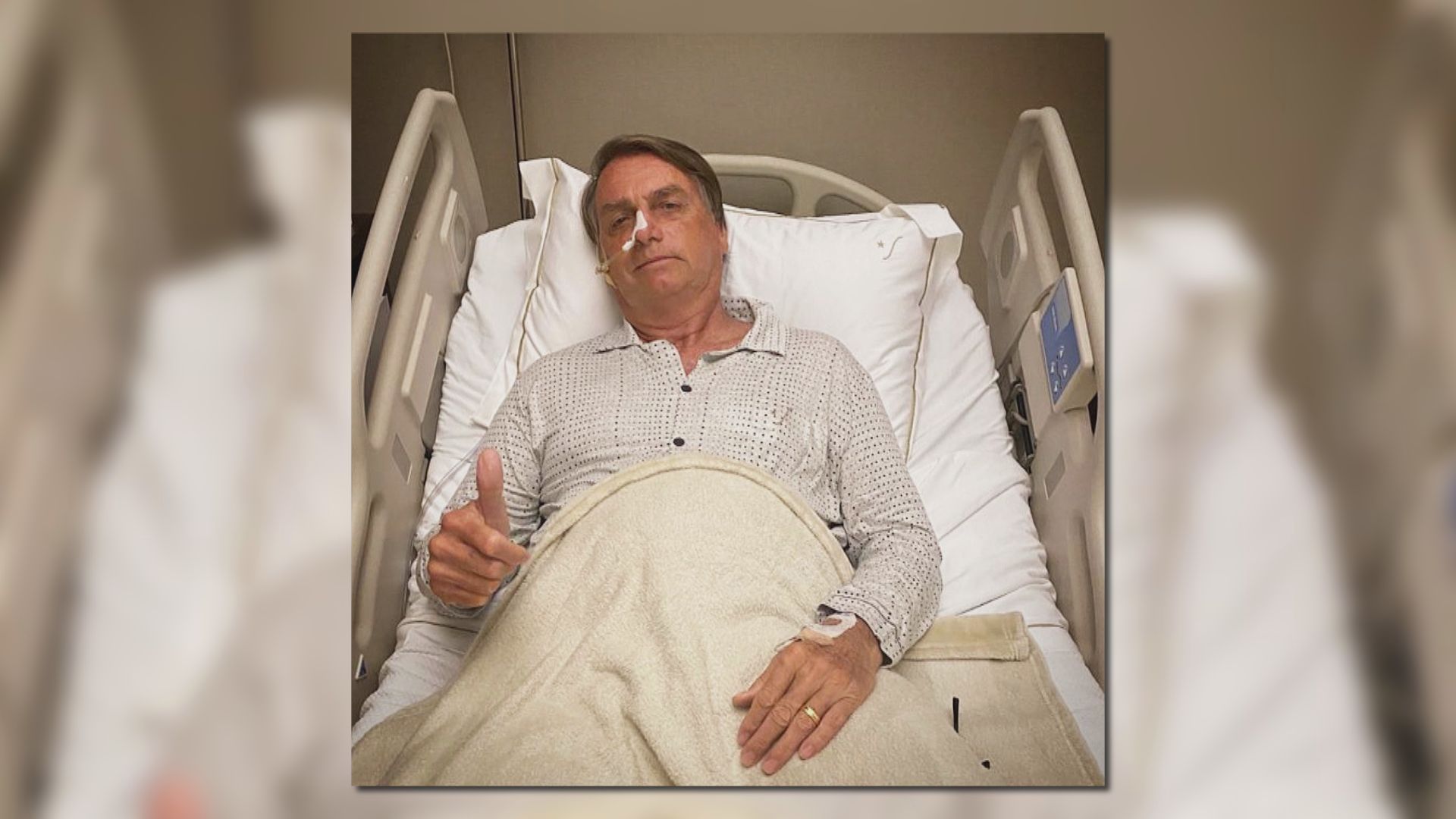 巴西總統博索納羅腸道阻塞入院